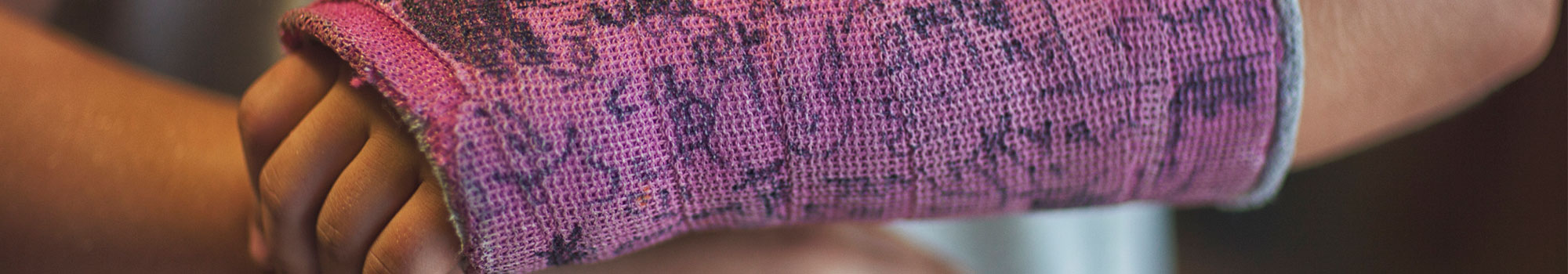 Little girl in arm cast