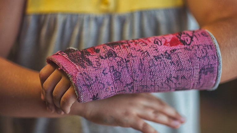 Young girl with pink cast